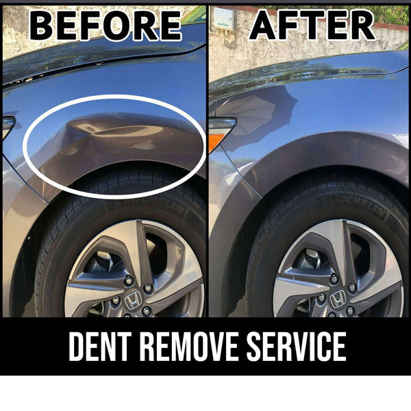 Services Dent Work